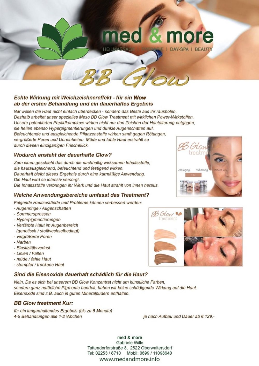 BB Glow — Ergebnis der Behandlung